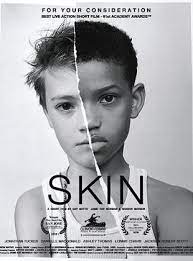 affiche du film Skin